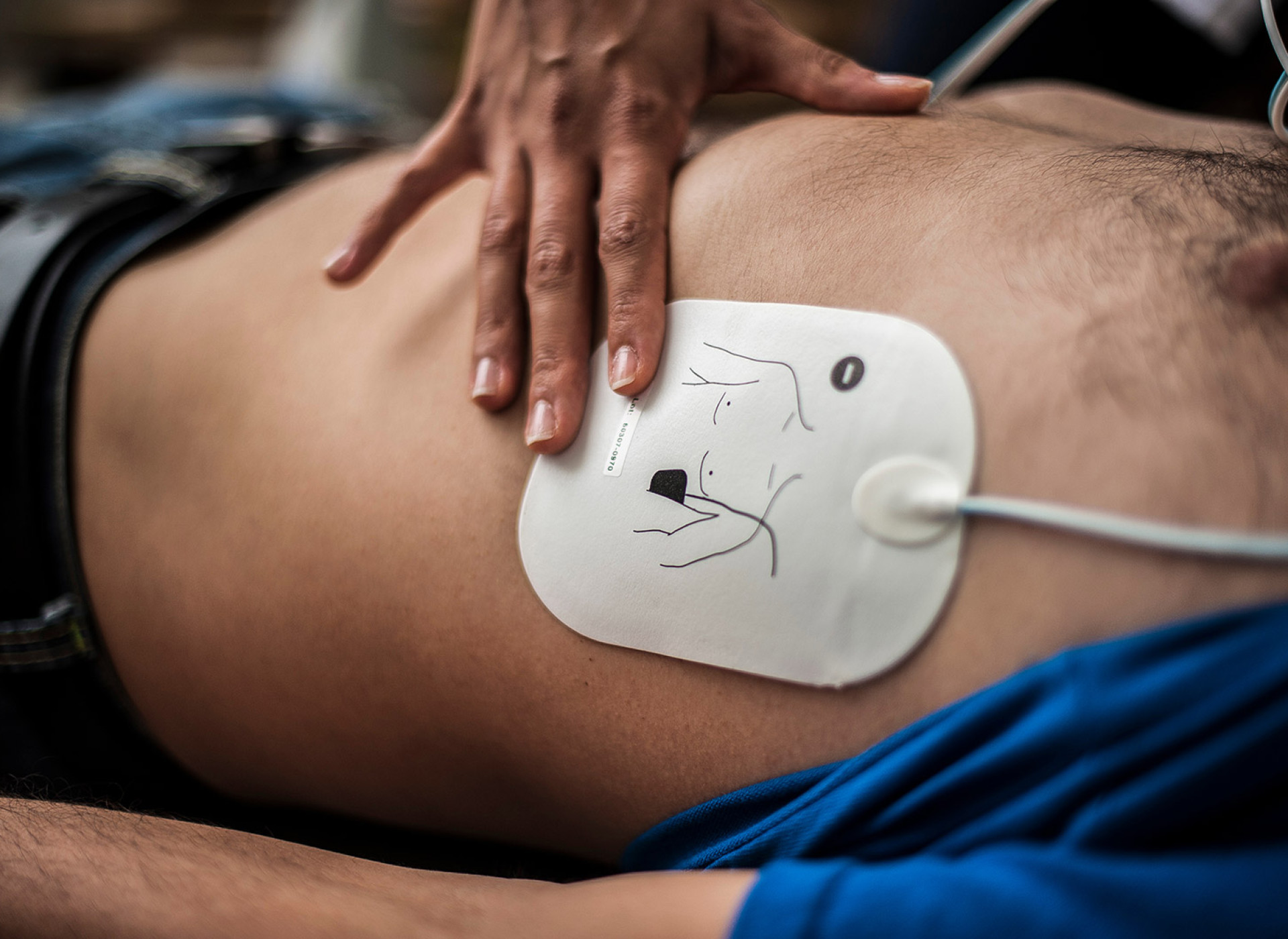 Zinnfolien Defibrillatoren